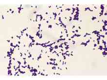 Listeria monocytogenes bakterier