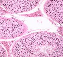 Testikulære interstitielle celler