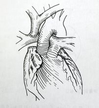 Single ventrikel